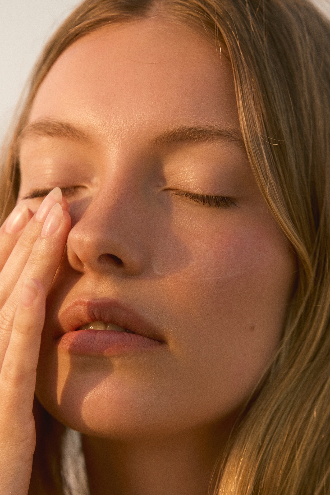 Dermal filler treatment