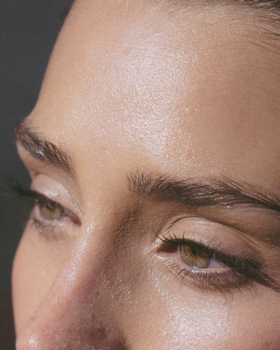 Neurotoxin treatment